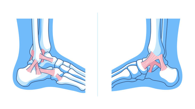 Human Ankle Anatomy Illustration featuring lateral and medial views of foot bones and ligaments ideal for medical education and orthopedic clinics.