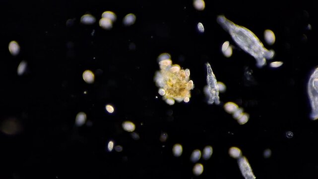 Active Paramecium ciliates and living microorganisms under darkfield microscope