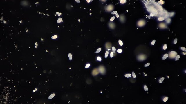 Active Paramecium ciliates and living microorganisms under darkfield microscope