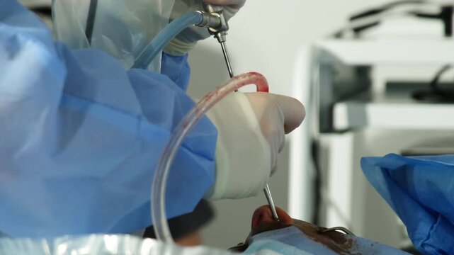 Skilled surgeon conducts arthroscopy procedure with special tools in hospital room closeup. Doctor diagnoses and treats joint problems in clinic