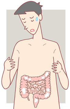 病気・疾患・疾病のイラスト - クローン病・炎症性腸疾患・潰瘍