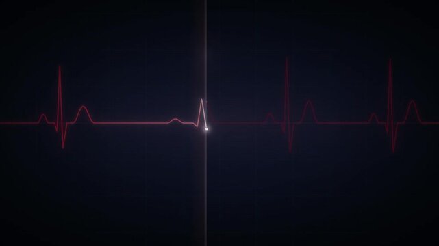 Glowing red electrocardiogram monitor flatlining with cardiac arrest