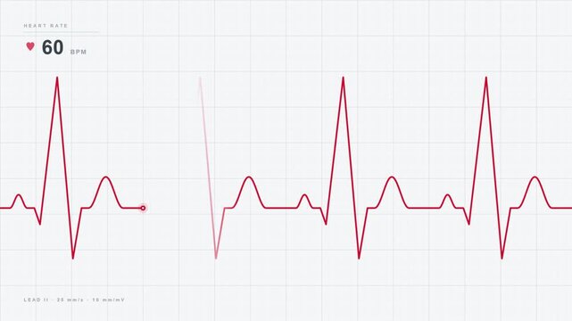 Red electrocardiogram heart rate monitor tracing on a white grid
