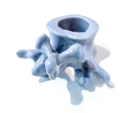 Anatomical human vertebra printed on 3D printer from liquid resin isolated on white background. Object created using photopolymer resin. SLA technology Stereolithography. Additive modern manufacturing
