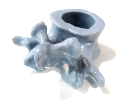 Anatomical human vertebra printed on 3D printer from liquid resin isolated on white background. Object created using photopolymer resin. SLA technology Stereolithography. Additive modern manufacturing