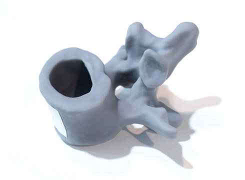 Anatomical human vertebra printed on 3D printer from liquid resin isolated on white background. Object created using photopolymer resin. SLA technology Stereolithography. Additive modern manufacturing
