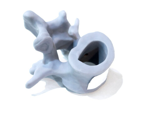 Anatomical human vertebra printed on 3D printer from liquid resin isolated on white background. Object created using photopolymer resin. SLA technology Stereolithography. Additive modern manufacturing