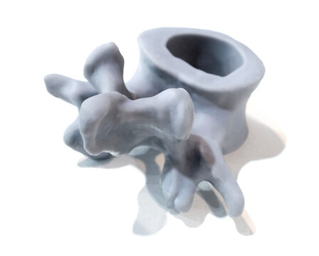Anatomical human vertebra printed on 3D printer from liquid resin isolated on white background. Object created using photopolymer resin. SLA technology Stereolithography. Additive modern manufacturing