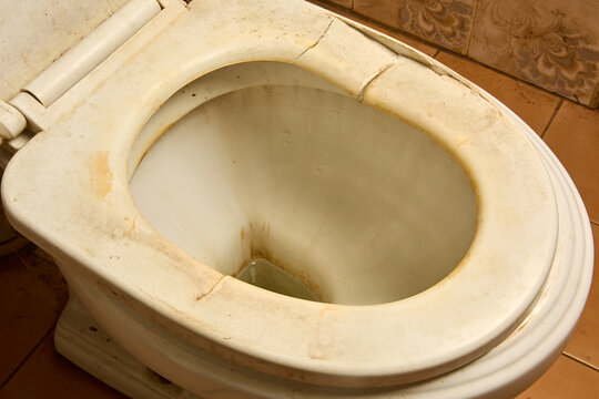 dirty old toilet seat in tiled bathroom, cracked plastic ring with brown stains and grime, in close-up view, poor hygiene and sanitation problem