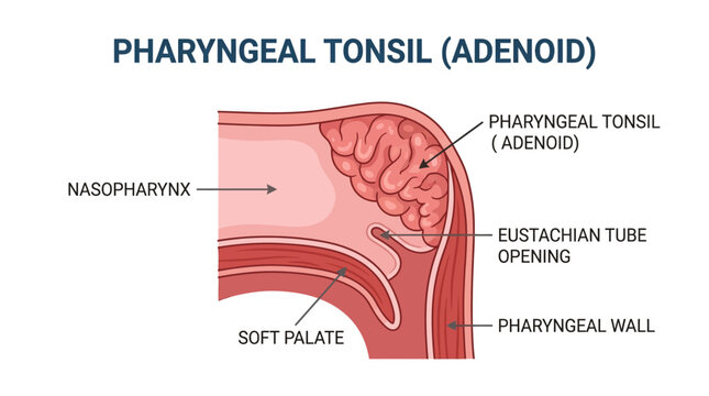 Detailed anatomical illustration of a pharyngeal tonsil also known as adenoid in the nasopharynx with labeled structures including eustachian tube opening and soft palate against a white
