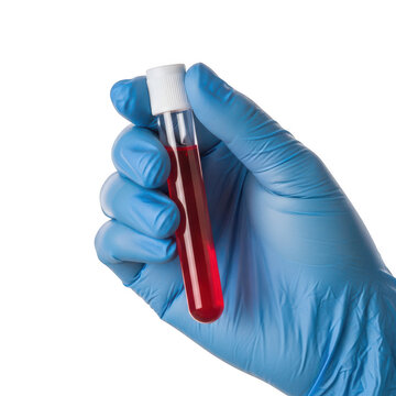 Doctor holding a glass test tube with red blood sample isolated on transparent background