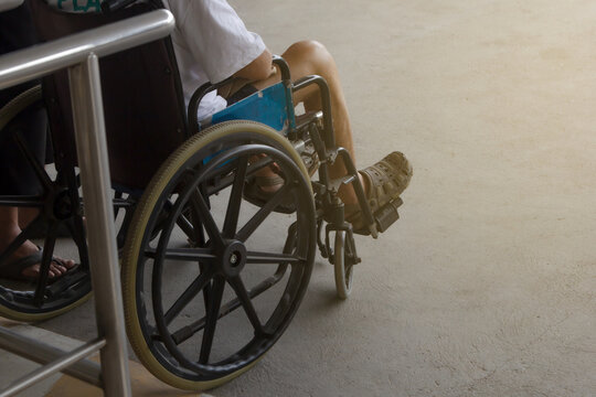 A patient is seated in a wheelchair.