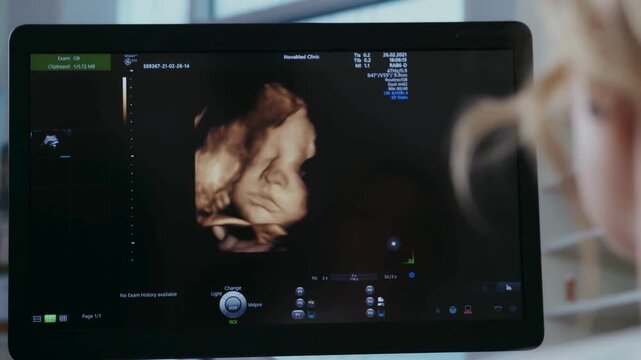 Expectant mother watching 3D fetal ultrasound scan on clinic monitor