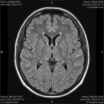 Brain MRI scan displays a T2-weighted axial cross section of a human head for clinical diagnostic analysis and medical research.