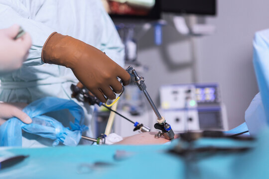 The surgeon's holing the instrument in abdomen of patient. The surgeon's doing laparoscopic surgery in the operating room. Minimally invasive surgery