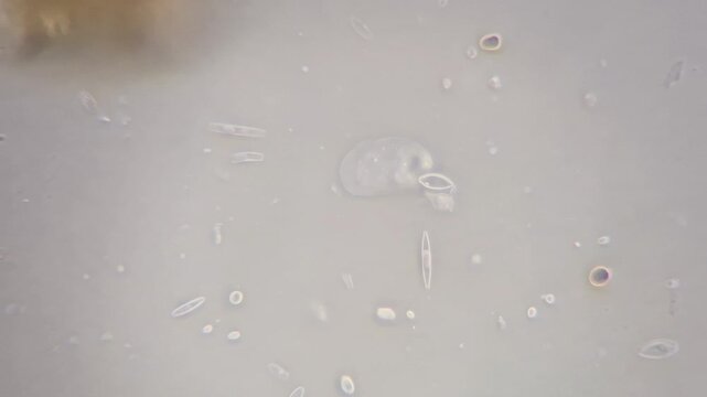 Real microscope footage of a moving amoeba microorganism