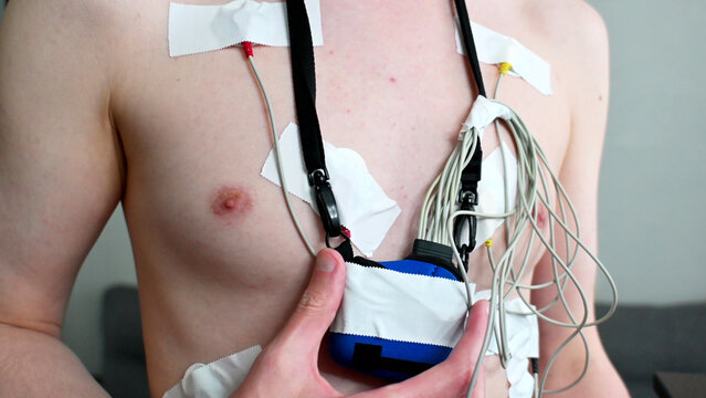 Male torso with holter monitor electrodes and recorder attached.