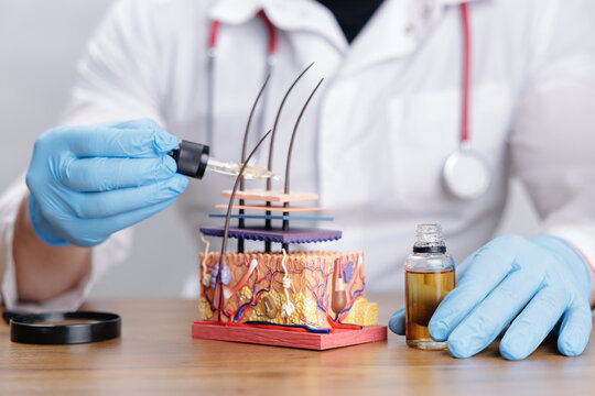 Doctor trichologist applying topical treatment with dropper oil to anatomical skin and hair model for medical dermatology