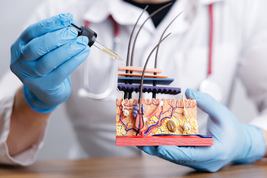 Closeup of clinician holding skin cross section model with hair follicles and dropper for dermatology in clinic