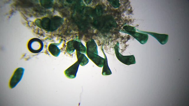 Microscopic view of Stentor ciliates attached to organic substrate under 40x brightfield magnification