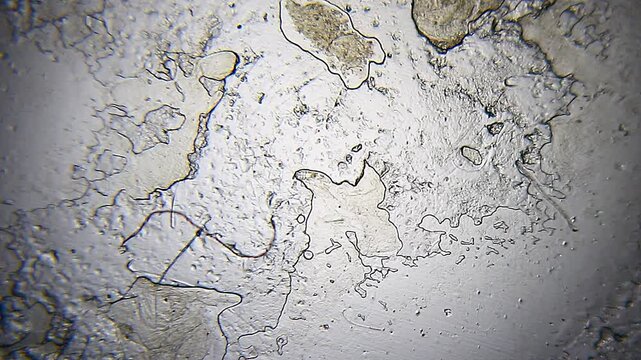 Microscopic view of Demodex brevis mite hidden among skin epithelial cells under 40x brightfield magnification