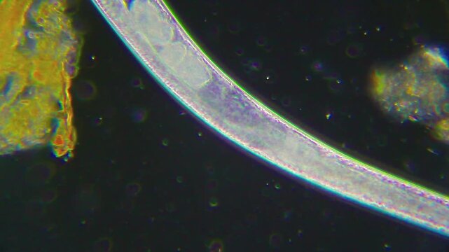 Panoramic microscopic view of a nematode worm with internal eggs under 400x darkfield magnification