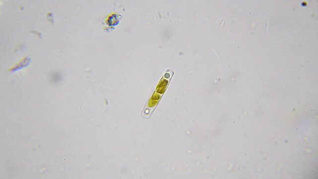 Single diatom alga surrounded by bacteria under 2000x brightfield oil immersion magnification