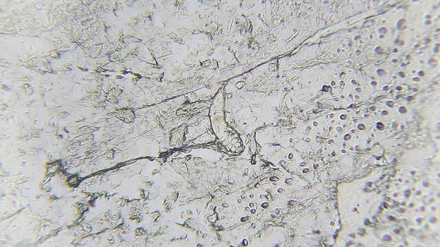 Demodex brevis skin mite on epithelial tissue under 100x brightfield magnification microscope