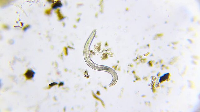 Nematode roundworm curved in S-shape under 100x brightfield magnification microscope