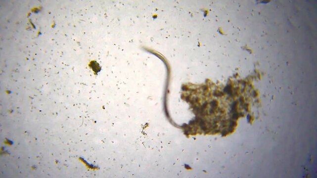 Active nematode worm moving among numerous small ciliates under 40x brightfield magnification microscope