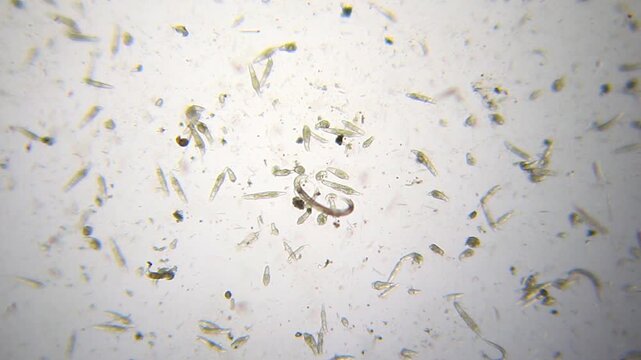Panoramic microscopic view of a rotifer cluster with a single nematode under 40x brightfield magnification