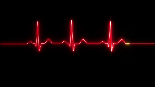 A closeup of an ekg monitor displaying a heart rhythm, representing cardiac health and medical technology. Neon Heartbeat Pulse Line on Dark Background