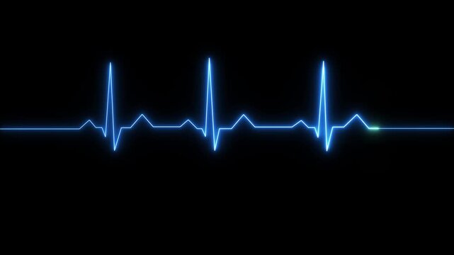 A closeup of an ekg monitor displaying a heart rhythm, representing cardiac health and medical technology. Neon Heartbeat Pulse Line on Dark Background