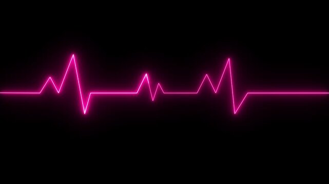 Cardiogram cardiograph oscilloscope screen. EKG 002: An electrocardiogram heart monitor pulses on a blue grid (Loop)