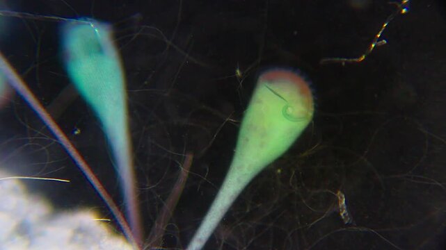 Trumpet-shaped Stentor ciliates attached to substrate filter feeding under 100x darkfield magnification