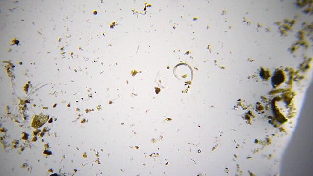 Single nematode roundworm curled in a ring under 40x brightfield magnification microscope