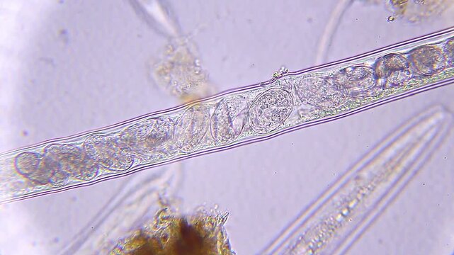 Microscopic view of internal eggs moving inside nematode roundworm under 400x brightfield magnification