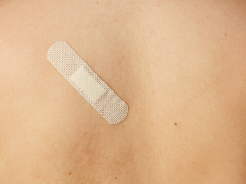 A band aid on someone's back