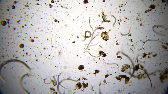 Nematode worms distributed in a liquid sample with suspended particles under 40x brightfield