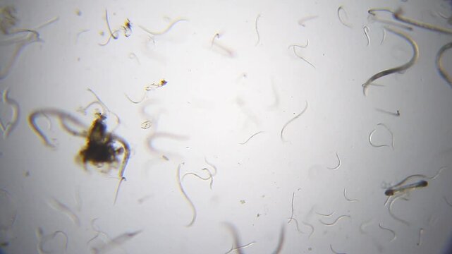 Panoramic micro view of a mixed-size nematode worm colony under 40x brightfield magnification