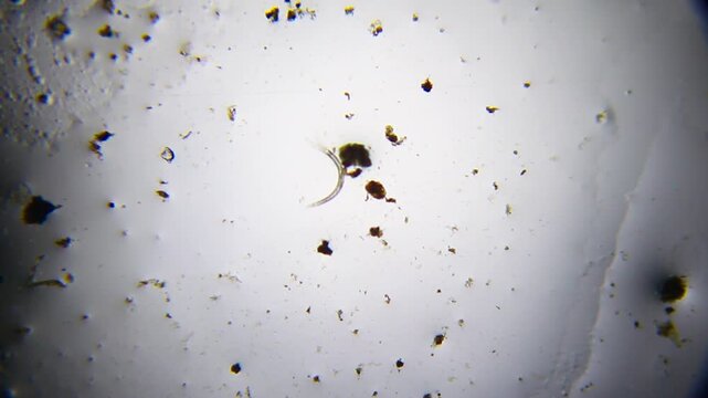 Microscopic view of a single nematode worm in a water droplet under 40x brightfield magnification