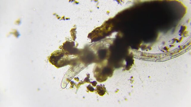 Annelid segment worm hidden in organic detritus among bacteria and ciliates under 40x brightfield
