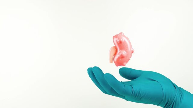 A doctor's hand, wearing green gloves, shows a kidney with cysts. Kidney health, diagnosis of benign renal cysts, follow-up urological ultrasound. Isolated on a white background.