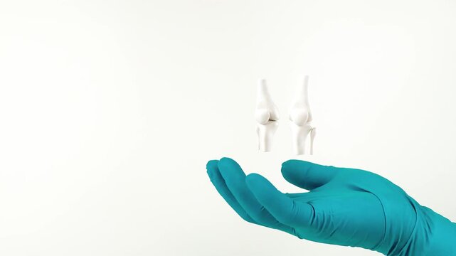 A doctor's hand, wearing green gloves, shows the bones of the knee. Bone health, prevention of osteoarthritis, joint pain, and cartilage wear. Isolated on a white background.