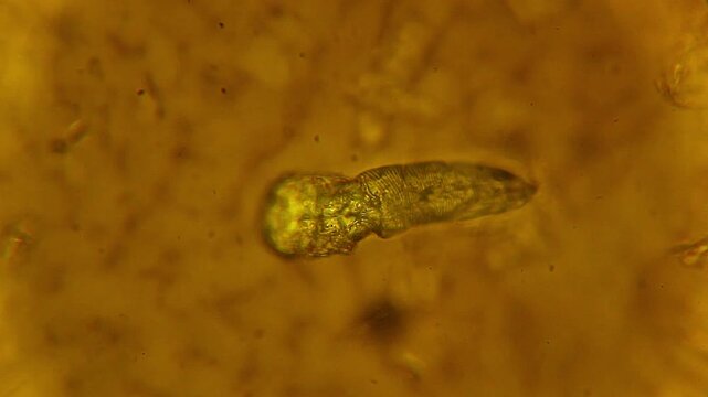 Demodex brevis face mite stained with iodine under 400x brightfield microscopy magnification