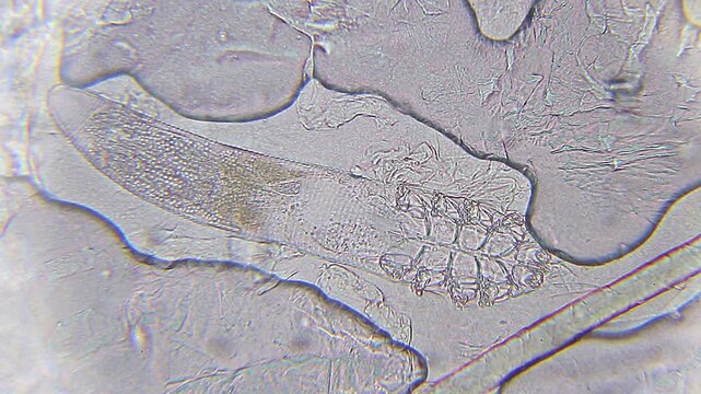 Demodex folliculorum face mite on human hair background under 400x brightfield magnification