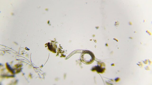Nematode roundworm curling into a loop in a drop of dirty water under 100x brightfield microscopy magnification
