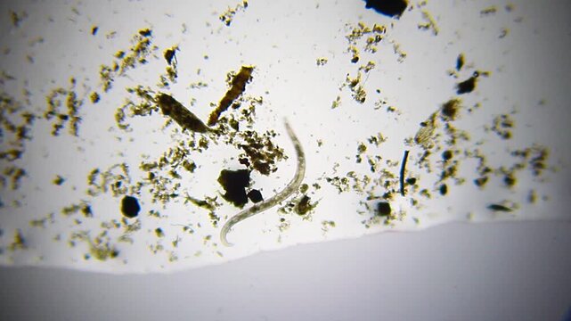 Large active nematode roundworm moving fast in a drop of dirty water under 40x brightfield microscopy magnification