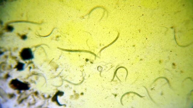 Multiple nematode roundworms swimming in yellow water under 40x brightfield microscopy magnification