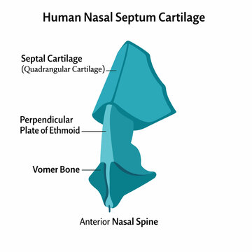Print